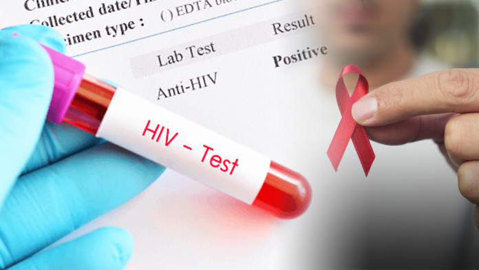 People infected with HIV