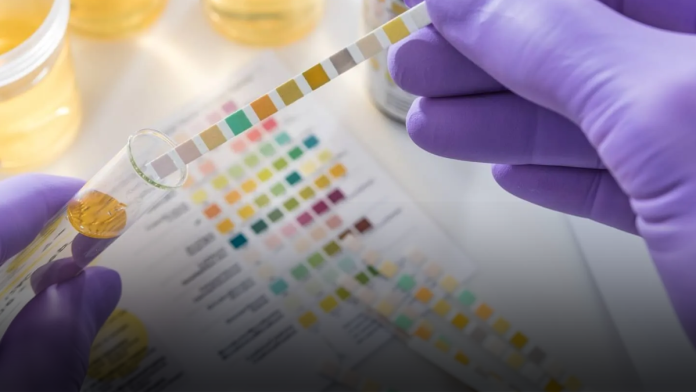 12 Panel Drug Testing